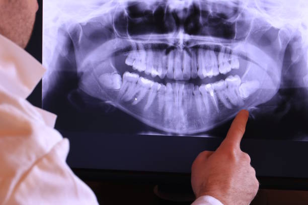 Best Tooth Infection Emergency Dentist  in Muskegon Heights, MI