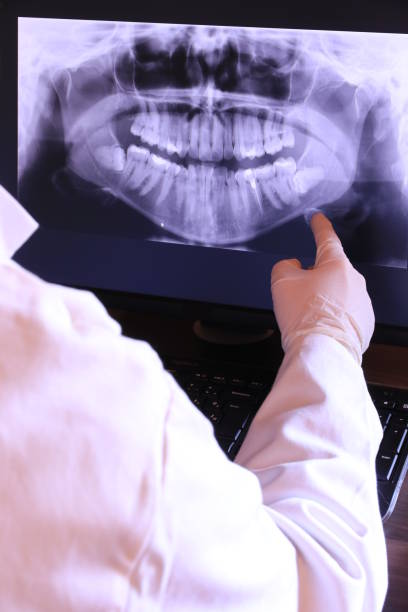 Best Dentist for Tooth Abscess  in Muskegon Heights, MI