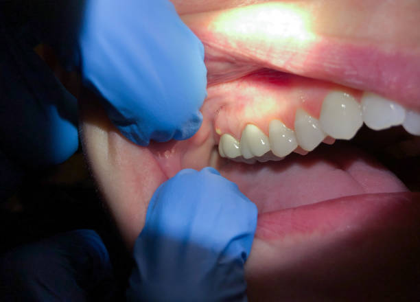 Best Knocked-Out Tooth Emergency  in Muskegon Heights, MI